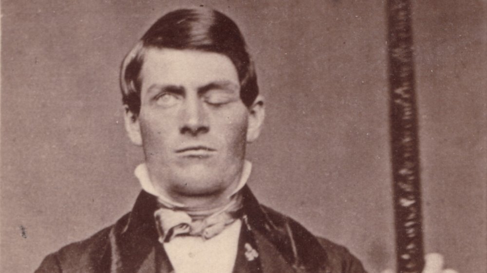 Phineas Gage