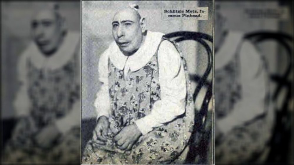 Schlitzie