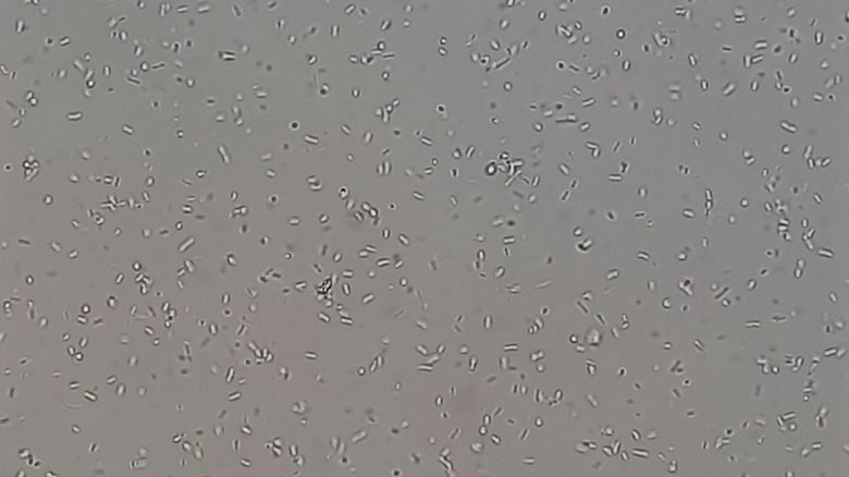Microscope image of bacteria