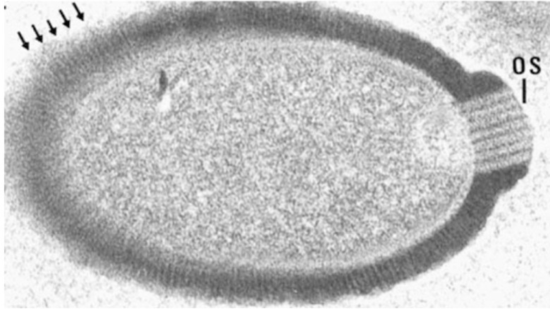 Micrograph of a Pithovirus virion