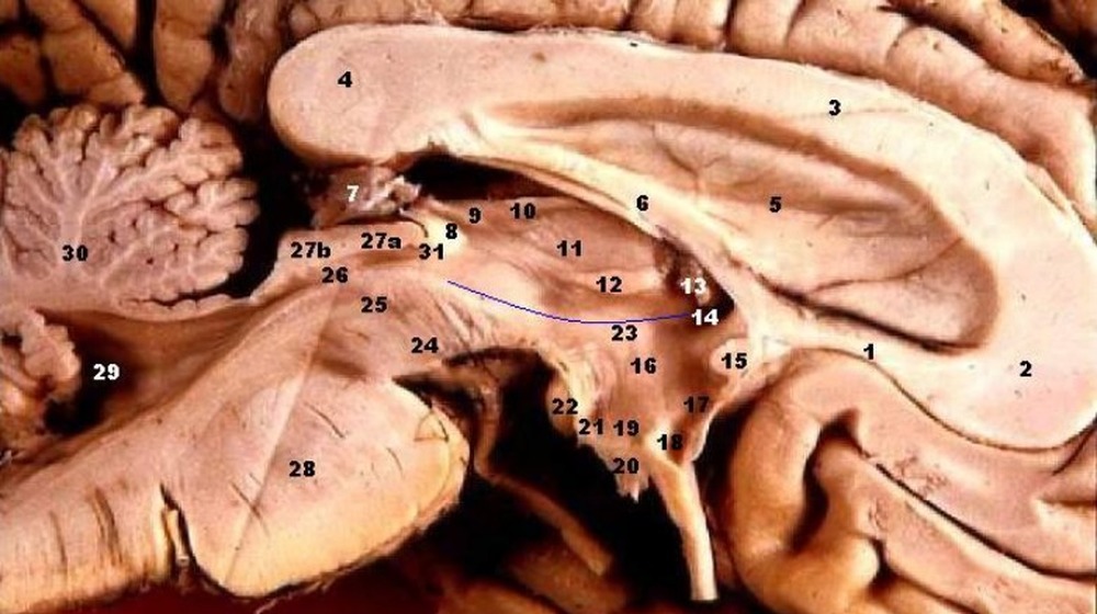 Cross section of human brain