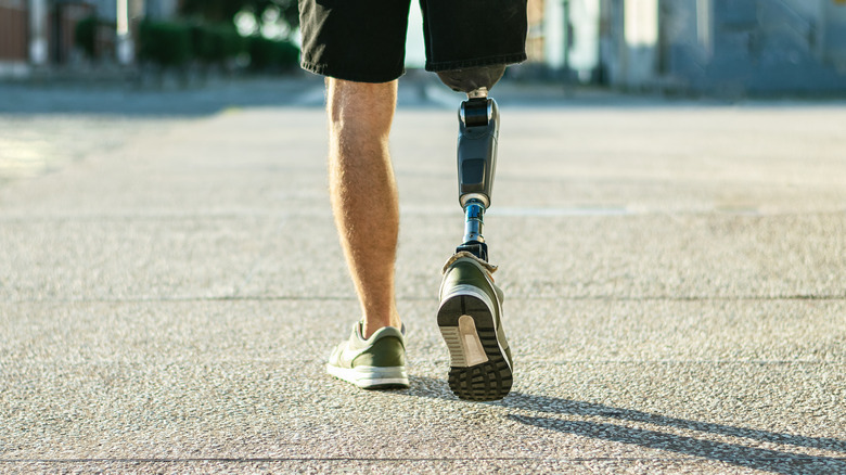 man walking with prosthetic leg