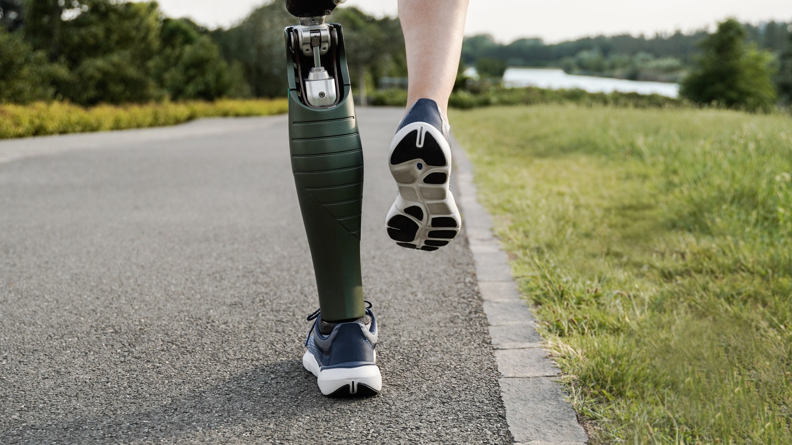 This Is What They Do With Implants And Prosthetics Before Cremation