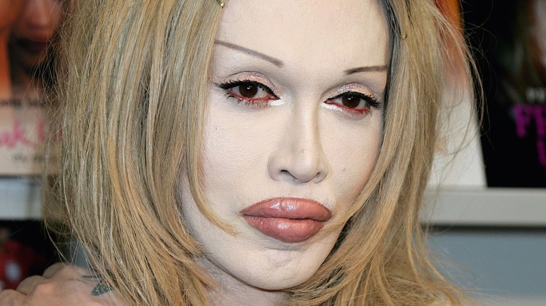 Pete Burns