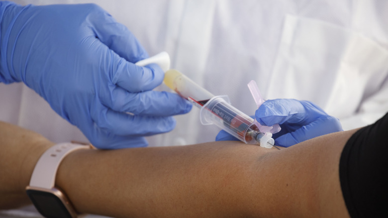 Taking a blood sample