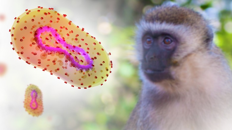monkeypox virus image