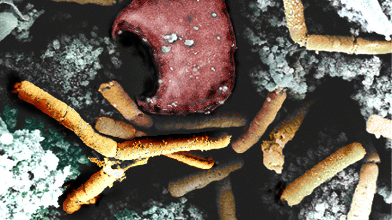 yellow anthrax bacteria