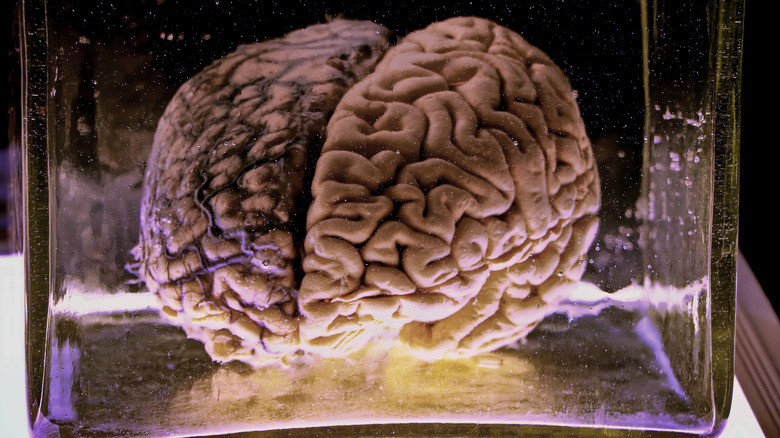 brain preserved in jar