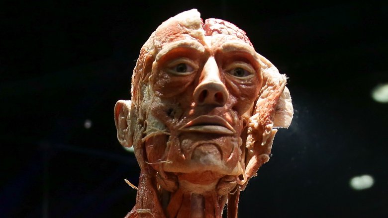 Plastinated body