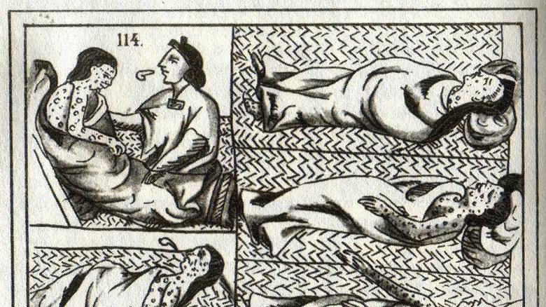 Florentine Codex depicting smallpox