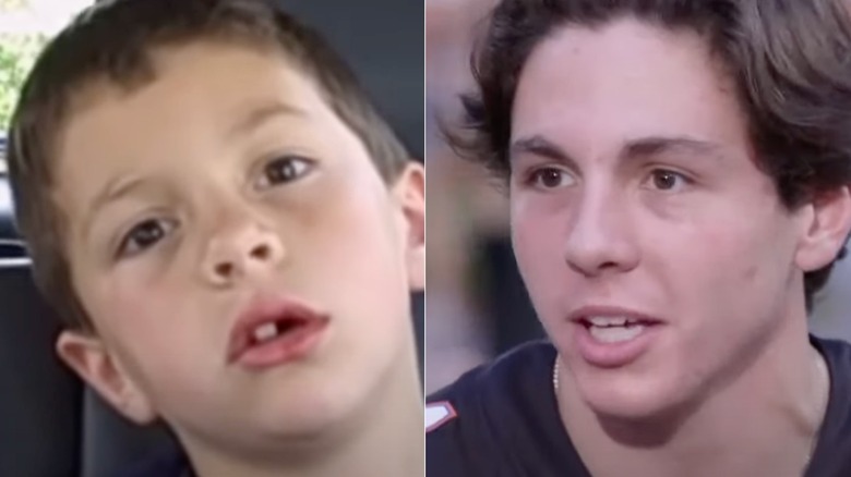 David After Dentist in video and years later
