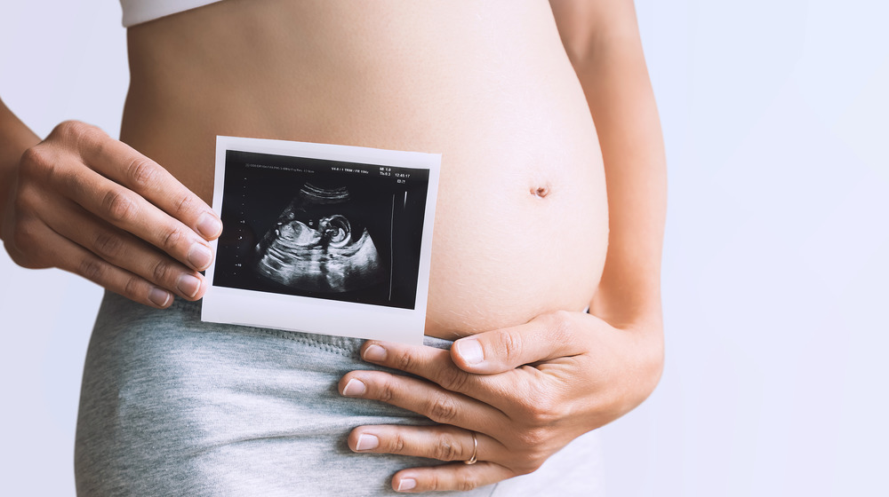 Pregnant woman holds ultrasound photo