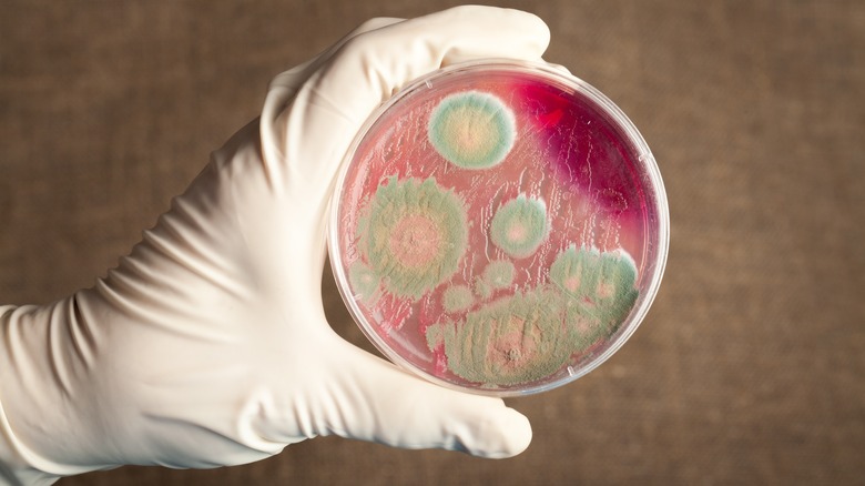 Anthrax in a petri dish