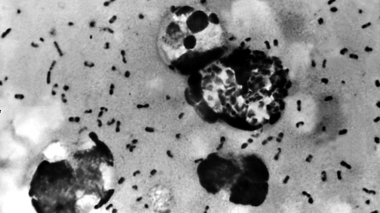 the yersinia pestis bacterium