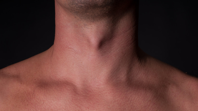 Adam's apple close-up