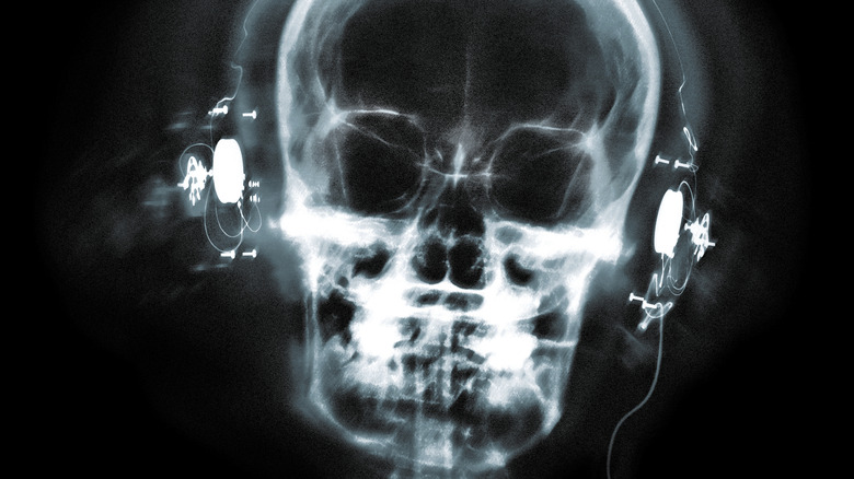 Person listening to headphones in xray