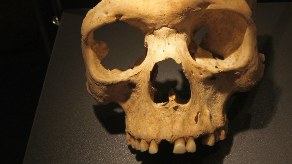 Herxheim skull