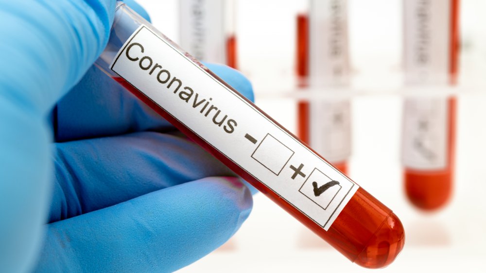 Coronavirus