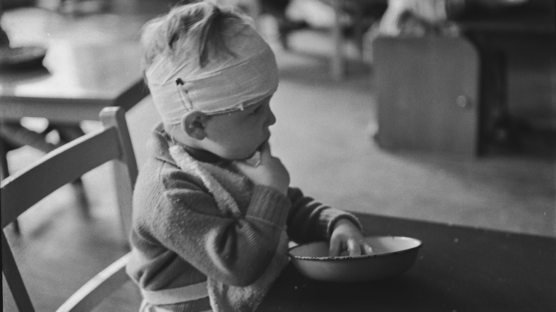 an injured toddler evacuated from london world war II 